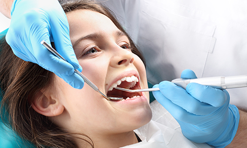 Dental cleanings in Charlotte NC.