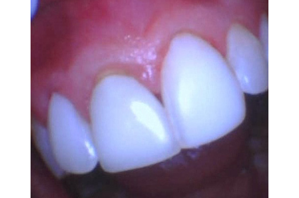 Right Image