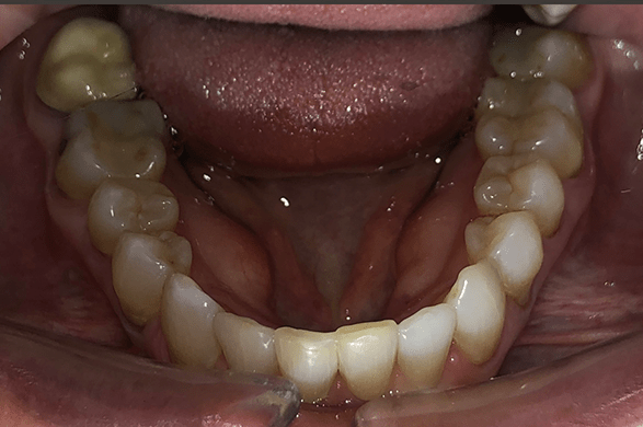 Right Image