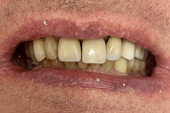Left Image