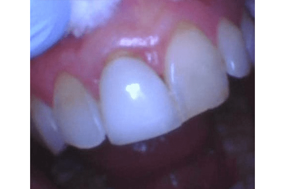 Left Image